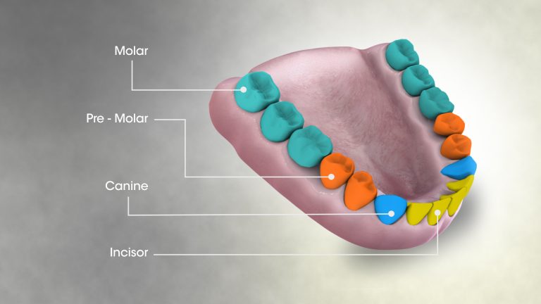 Should I Worry About My Wisdom Teeth? - Alphington Dental Care