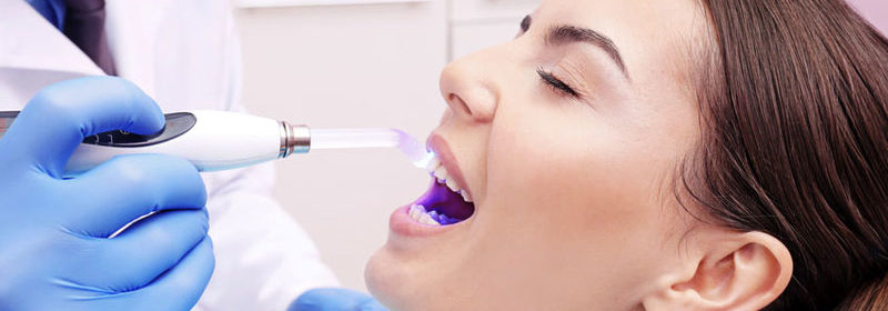 What You Need To Know About Tooth Extractions