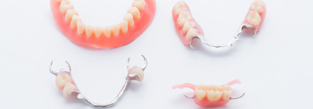 Different Types Of Dentures And Their Benefits