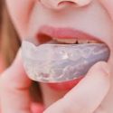 How to Clean a Mouth Guard: A Comprehensive Guide