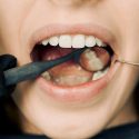 Tooth Extraction vs. Root Canal: Which Is Best for You?