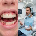 Can Gum Disease Be Reversed?