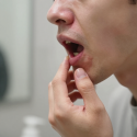 What Are the Early Signs of Gum Disease?